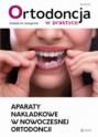 Aparaty nakładkowe w nowoczesnej ortodoncji